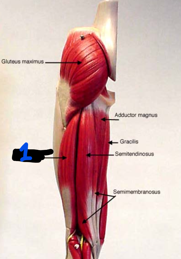 <p><span style="font-family: Arial, sans-serif">What is the origin and insertion of this muscle?</span></p>