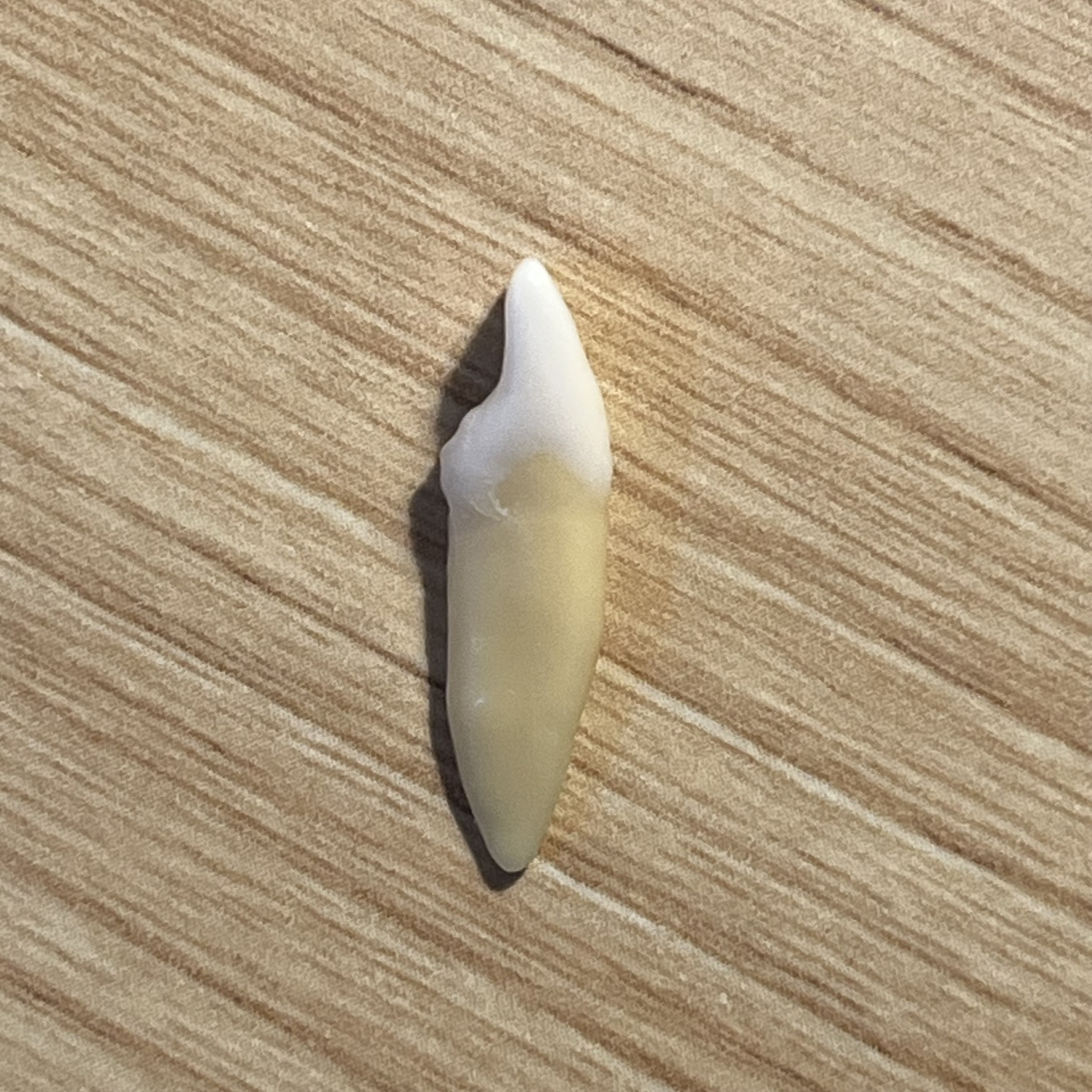 <p>What tooth is this (with view)?</p>