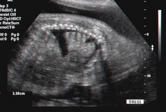 term image