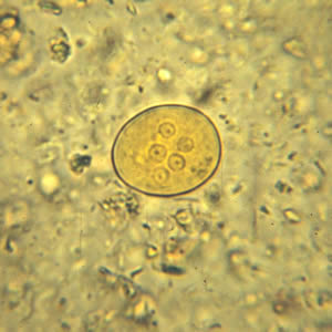 <p>more than four nuclei</p>