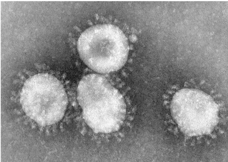 <ul><li><p>Enveloped, ssRNA</p></li><li><p> Cause of pharyngitis and<em> most colds</em> occurring during the <em>winter months</em></p></li><li><p> Transmission via <strong>respiratory secretions</strong></p></li><li><p>Word “Coronavirus” is derived from Latin corona, meaning crown or halo.</p></li><li><p> Under EM each virion appears corona or halo. This is due to the presence of<strong> viral spikes peplomers emanating from each proteinaeous envelope.</strong></p><p></p></li><li><p><strong> Common human corona viruses</strong></p><ul><li><p> Alphacoronaviruses: HcoV-229E, HCoV-NL63</p></li><li><p> Beta coronaviruses: HCoV-oc43, HCoV-HKU1</p></li></ul></li><li><p><strong>Effects upper respiratory and gastrointestinal tract of mammals and bird.</strong></p><ul><li><p> SARS-CoV-1</p></li><li><p> Mers-Cov</p></li><li><p> SARS-CoV-2</p><p></p><p></p></li></ul></li></ul><p></p>