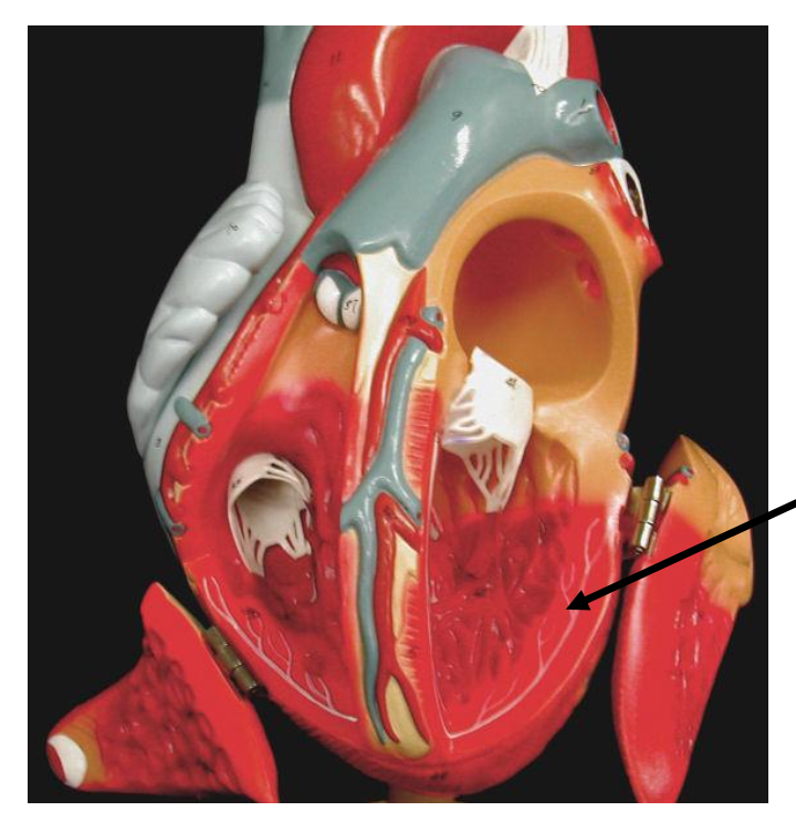<p>Black arrow is pointing to </p><p></p><p>a. Coronary artery</p><p>b. Cruca</p><p>c. Purkinje fibers</p><p>d. Chordae tendinae</p>
