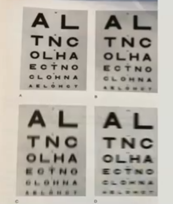 <p>spherical vs astigmatic defocus&nbsp;</p>
