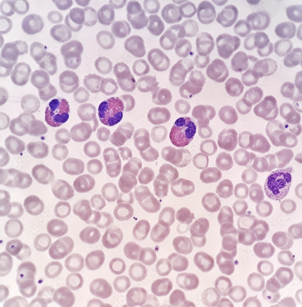 <p>-many cells with no nucleus, suspended in plasma</p><p>-function → transport gases, nutrients, hormones & water</p>