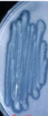 <p>Is this a negative or positive Lipid hydrolysis (Sprit blue agar) test?</p>