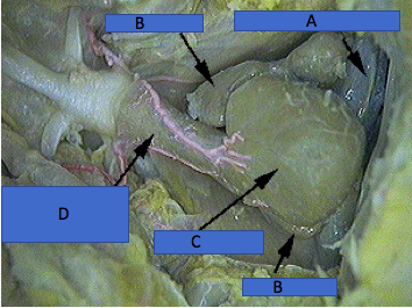 <p>Collects deoxygenated blood before the atrium — Thin‑walled sac posterior to atrium within pericardial cavity (A in picture)</p>