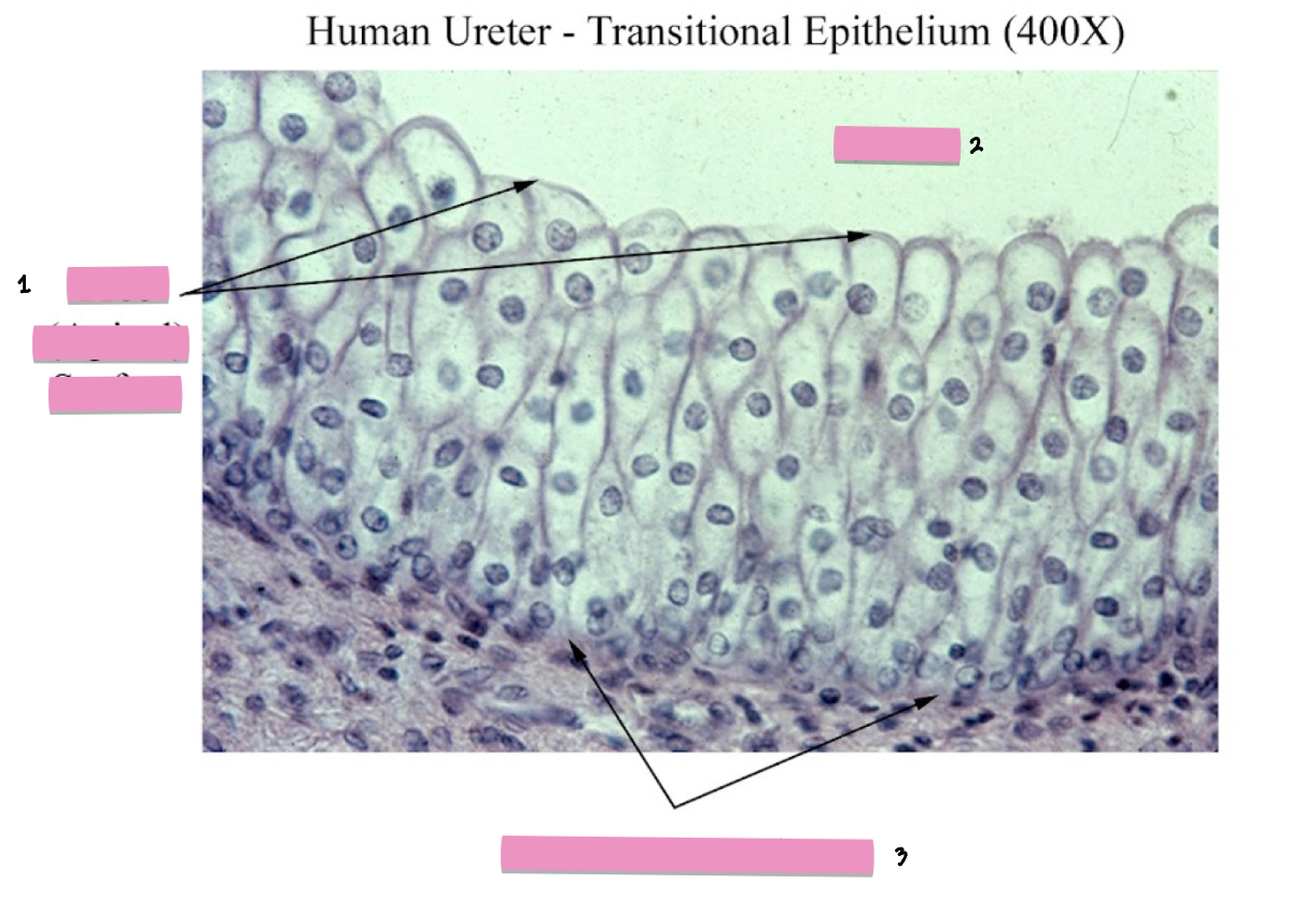 <p>(1) Transitional Epithelium tissue cellular characteristics</p>