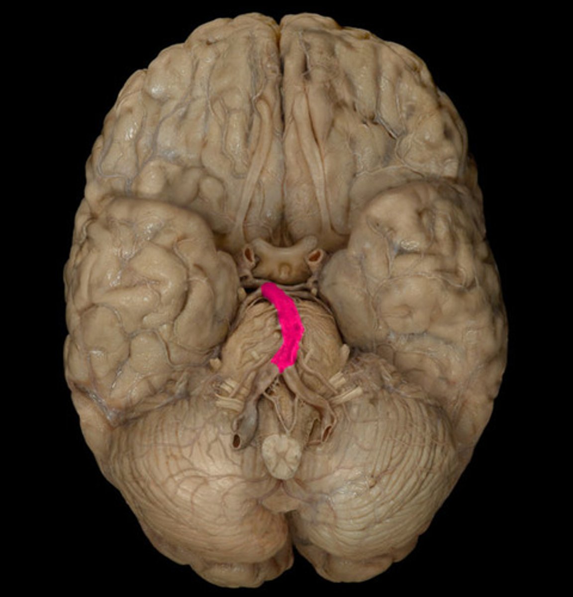 <p>-where vertebral arteries join</p><p>-1 inch in length</p><p>-then bifurcates</p>