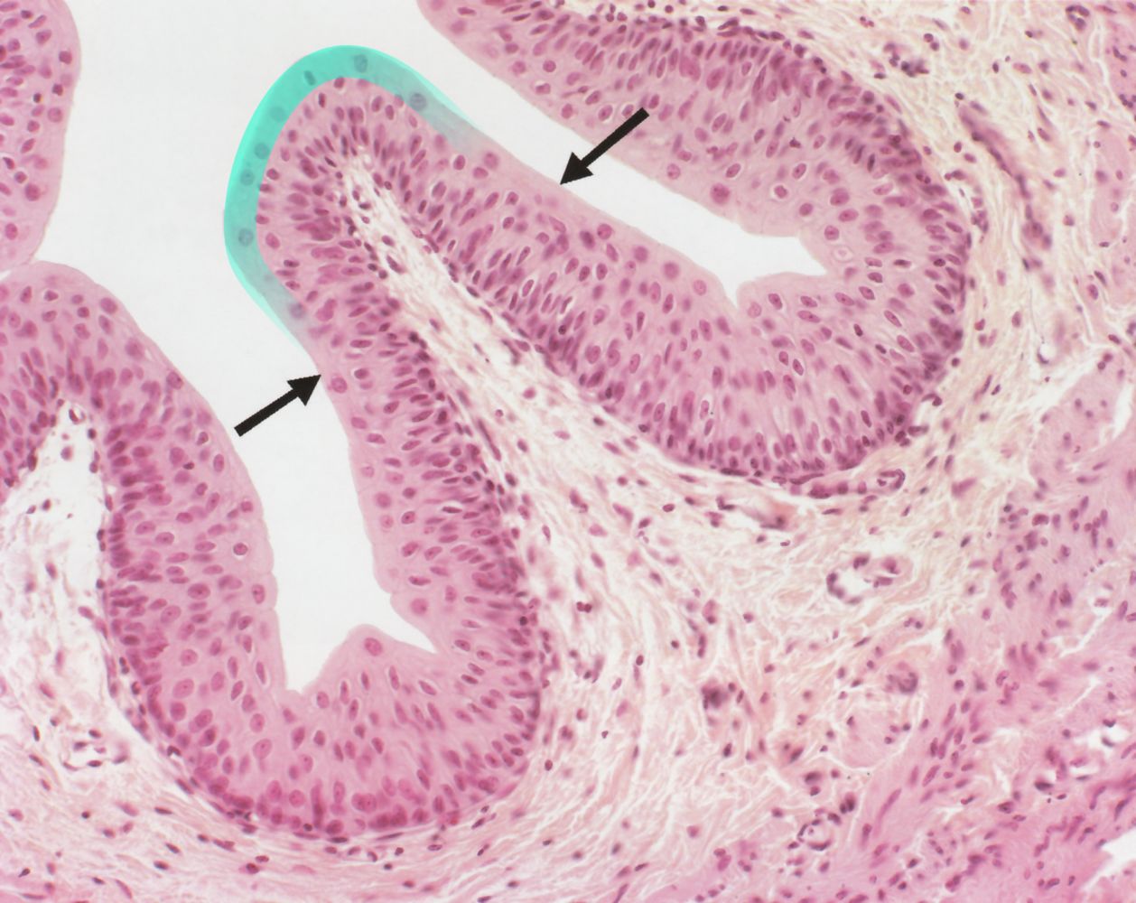 <p>glandular epithelium</p>