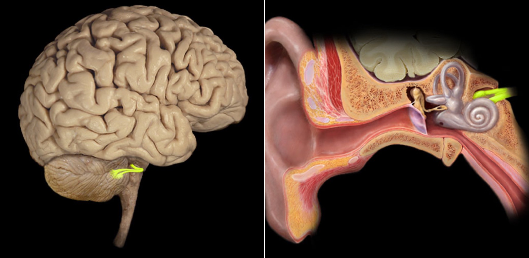 <h4 collapsed="false" seolevelmigrated="true"><strong>Location:</strong></h4><ul><li><p>Posterior cranial fossa</p></li><li><p>Petrous portion of temporal bone</p></li></ul><h4 collapsed="false" seolevelmigrated="true"><strong>Composition:</strong></h4><ul><li><p>Special sensation</p></li></ul><h4 collapsed="false" seolevelmigrated="true"><strong>Special sensation:</strong></h4><ul><li><p>Hearing (cochlea)</p></li><li><p>Balance (semicircular canals and vestibule)</p></li></ul><h4 collapsed="false" seolevelmigrated="true"><strong>Sensory ganglion:</strong></h4><ul><li><p>Cochlear (spiral) ganglion (cochlear part of CN VIII)</p></li><li><p>Vestibular ganglion (vestibular part of CN VIII)</p></li></ul><h4 collapsed="false" seolevelmigrated="true"><strong>CNS connection:</strong></h4><ul><li><p>Pons (vestibular nuclei)</p></li><li><p>Medulla oblongata (cochlear and vestibular nuclei)</p></li></ul><h4 collapsed="false" seolevelmigrated="true"><strong>Cranial foramina:</strong></h4><ul><li><p>Internal acoustic meatus</p></li></ul><h4 collapsed="false" seolevelmigrated="true"><strong>Comment:</strong></h4><ul><li><p>Special sensation includes smell, vision, taste, hearing, and balance</p></li><li><p>Vestibulocochlear nerve has two distinct functional components: vestibular (balance) and cochlear (hearing)</p></li><li><p>Vestibulocochlear nerve also known as CN VIII</p></li></ul>