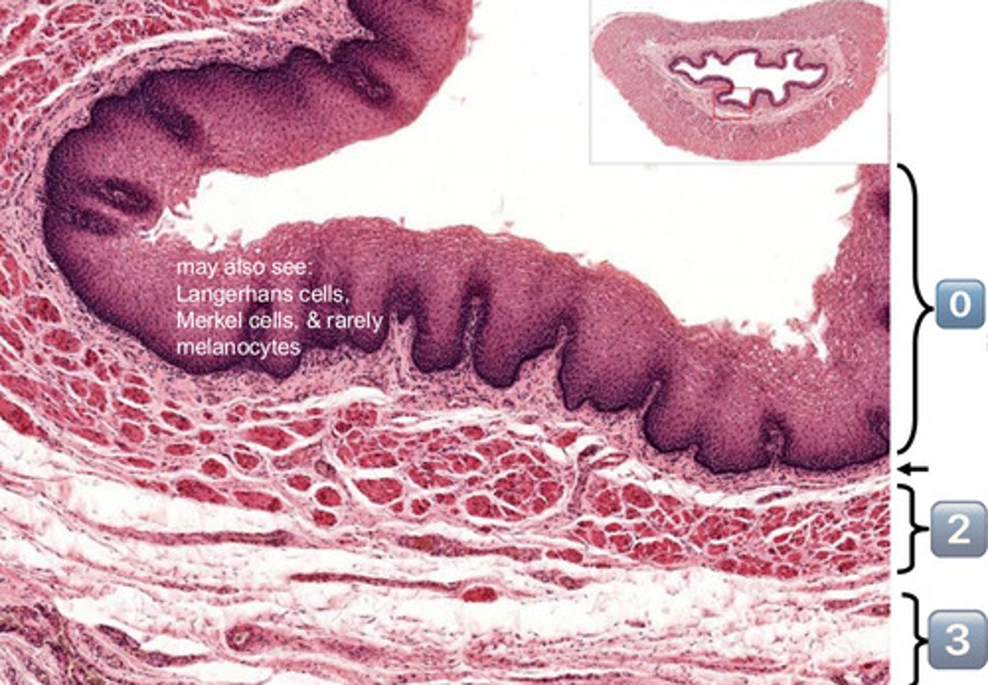 <p>epithelium (SSNKE)</p>