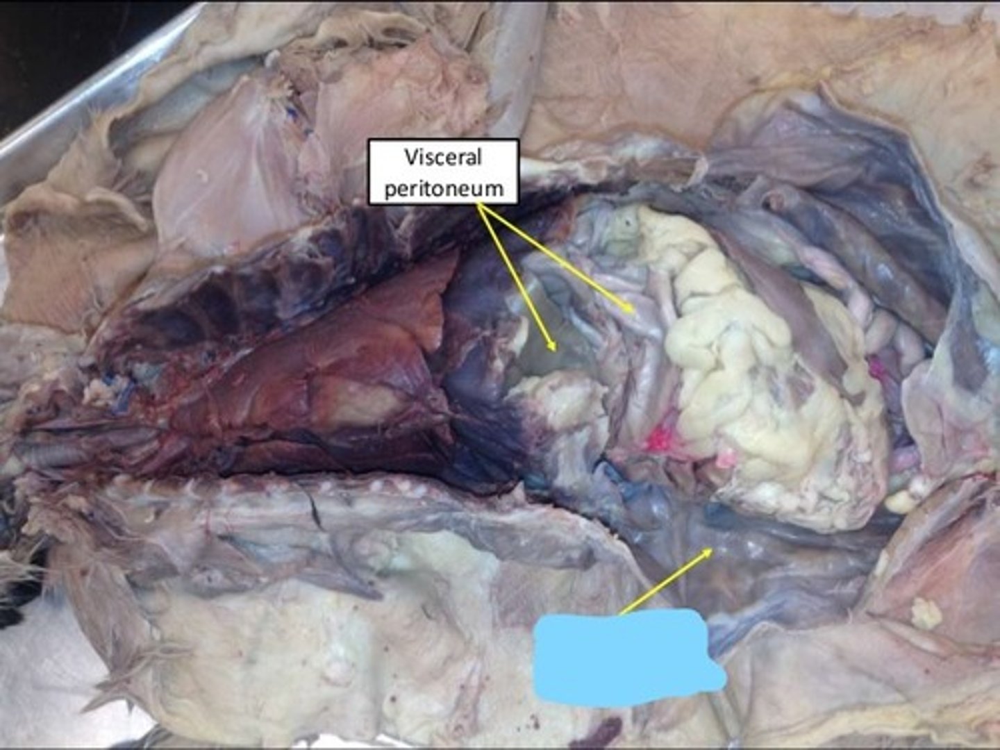 <p>deeper to parietal</p>