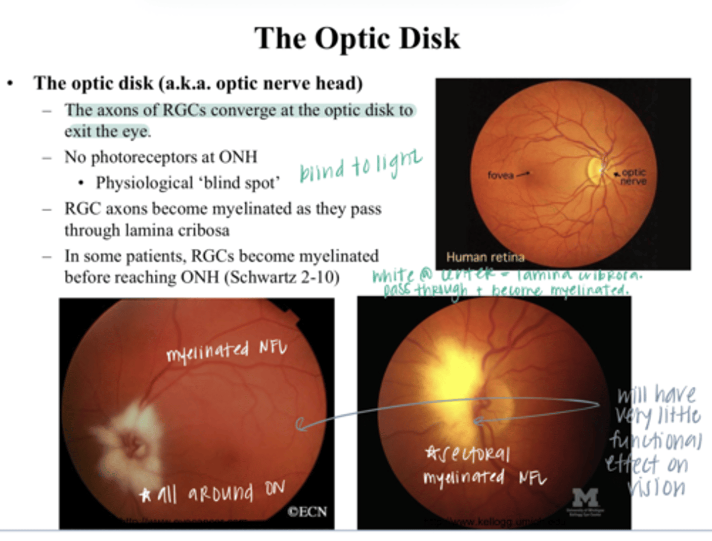 <p>the axons of the retinal ganglion cells converge where to exit the eye?</p>