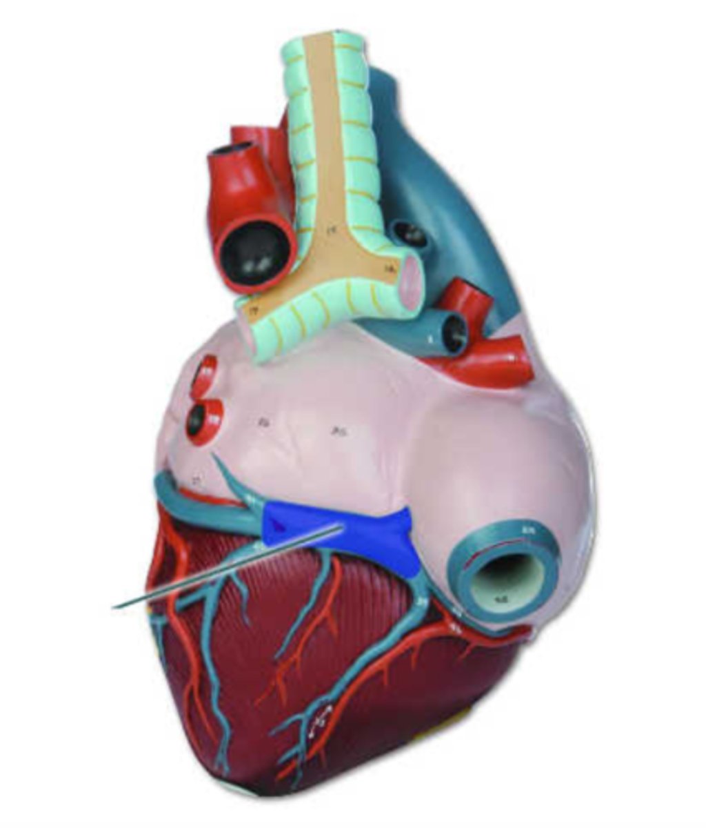 <p>coronary sinus</p>