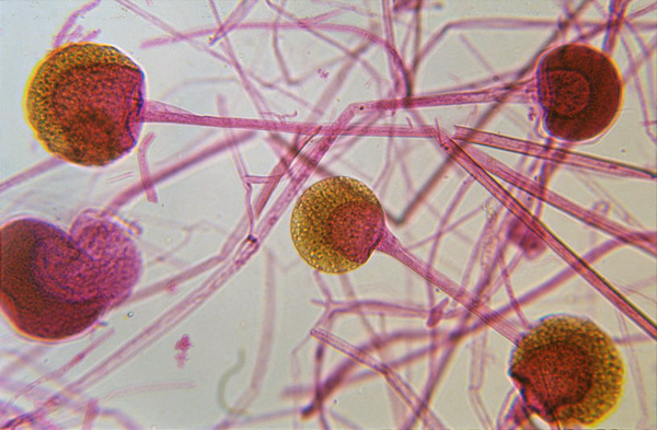 <p>What is pictured? Does it undergo sexual or asexual reproduction? What phylum does it belong to?</p>