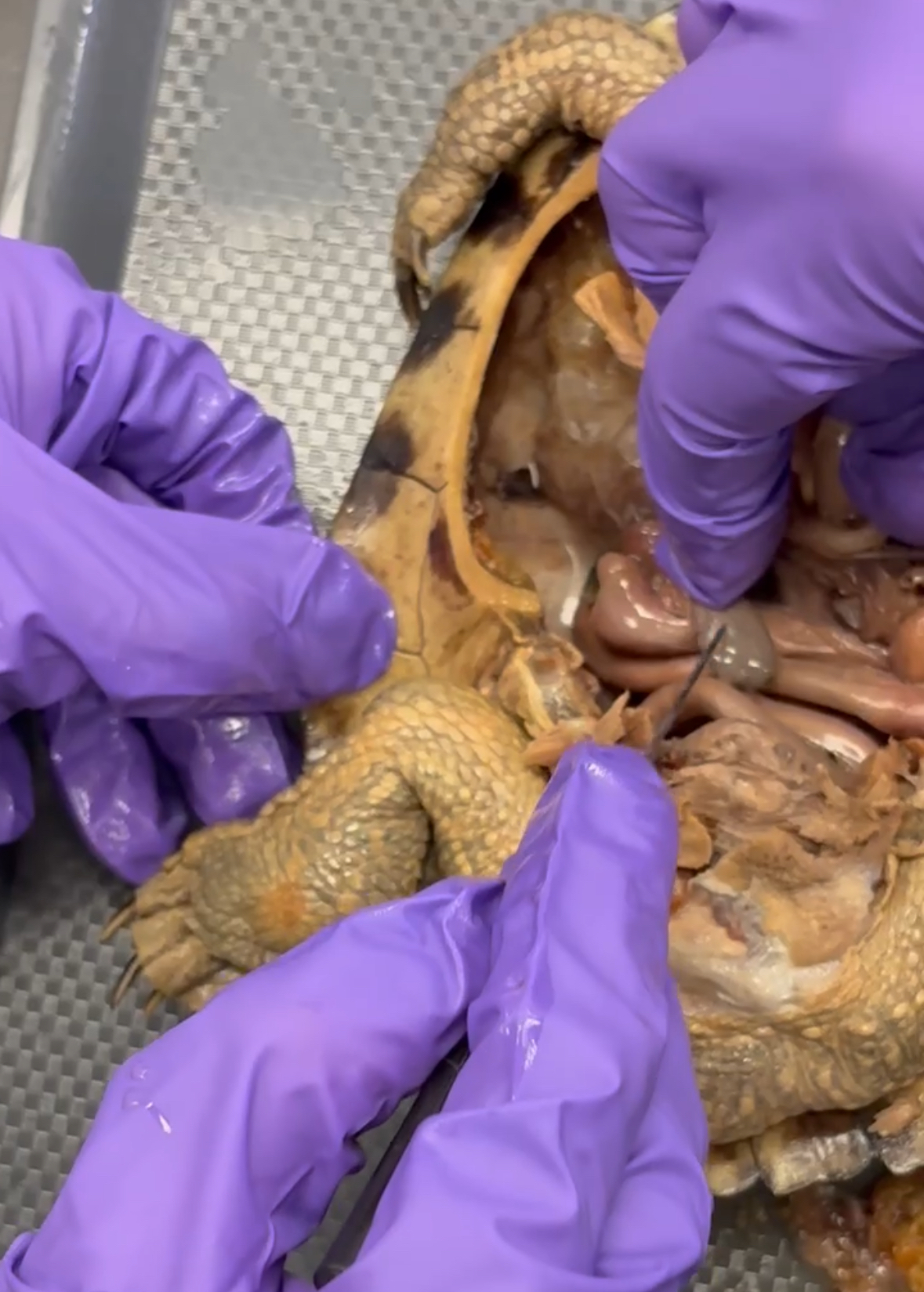 <p>? dug from underneath intestine*</p>