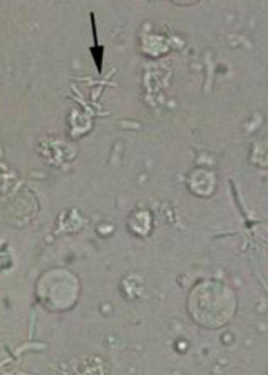 <p>- Small amount seen in free catch</p><p>- Should see none in cysto or catheterization</p><p>- Look for background movement</p><p>- Rods or cocci</p><p>- Identify on high dry</p><p>- Indicates UTI</p>