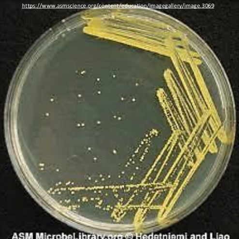 <p>pure culture (axenic culture), single</p>