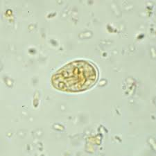 <p>Identify this 15 µm protozoan cyst.<br></p><p>Balantidium coli</p><p>Chilomastix mesnili</p><p>Endolimax nana</p><p>Entamoeba histolytica</p><p>Giardia lamblia (duodenalis)</p>