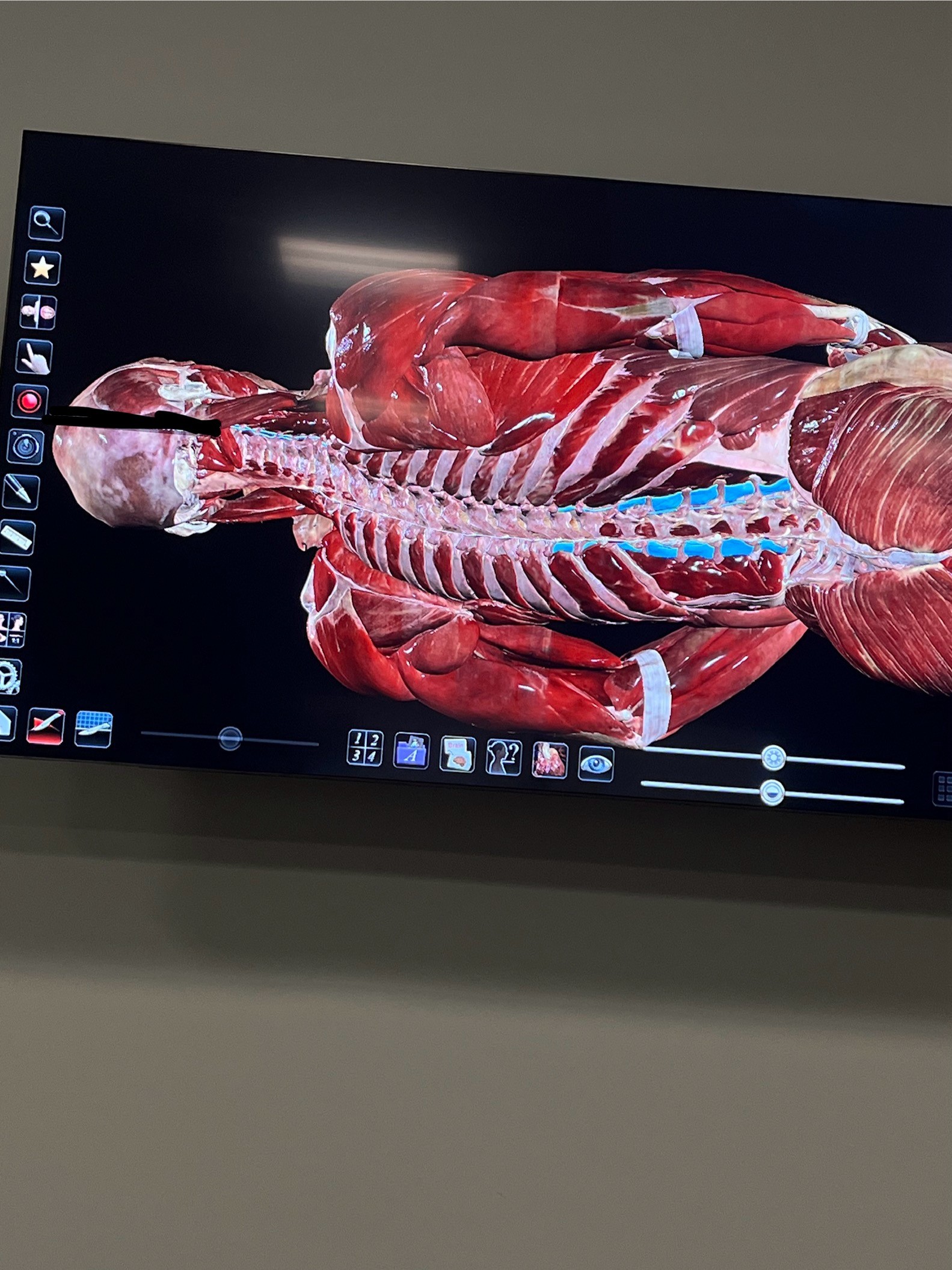 <p>What spinal muscle is this</p>