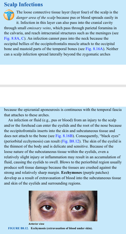 <p>The loose connective tissue layer (layer four) of the scalp is the danger area of the scalp because pus or blood spreads easily in it. Infection in this layer can also pass into the cranial cavity through small emissary veins, which pass through parietal foramina in the calvaria, and reach intracranial structures such as the meninges (see Fig. 8.8A, C). An infection cannot pass into the neck because the occipital bellies of the occipitofrontalis muscle attach to the occipital bone and mastoid parts of the temporal bones (see Fig. 8.16A). Neither can a scalp infection spread laterally beyond the zygomatic arches because the epicranial aponeurosis is continuous with the temporal fascia that attaches to these arches. An infection or fluid (e.g., pus or blood) from an injury to the scalp and/or the forehead can enter the eyelids and the root of the nose because the occipitofrontalis inserts into the skin and subcutaneous tissue and does not attach to the bone (see Fig. 8.16B). Consequently, “black eyes” (periorbital ecchymosis) can result (Fig. B8.12). The skin of the eyelid is the thinnest of the body and is delicate and sensitive. Because of the loose nature of the subcutaneous tissue within the eyelids, even a relatively slight injury or inflammation may result in an accumulation of fluid, causing the eyelids to swell. Blows to the periorbital region usually produce soft tissue damage because the tissues are crushed against the strong and relatively sharp margin. Ecchymoses (purple patches) develop as a result of extravasation of blood into the subcutaneous tissue and skin of the eyelids and surrounding regions.</p>