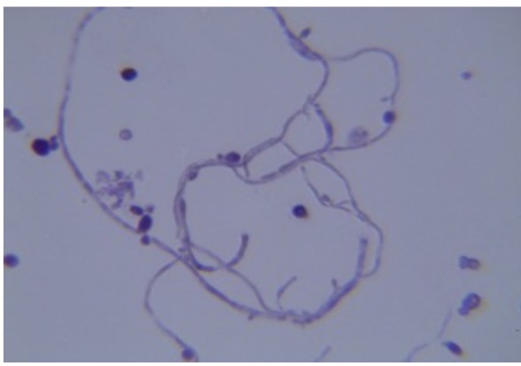 <p>Identify the fungi</p>