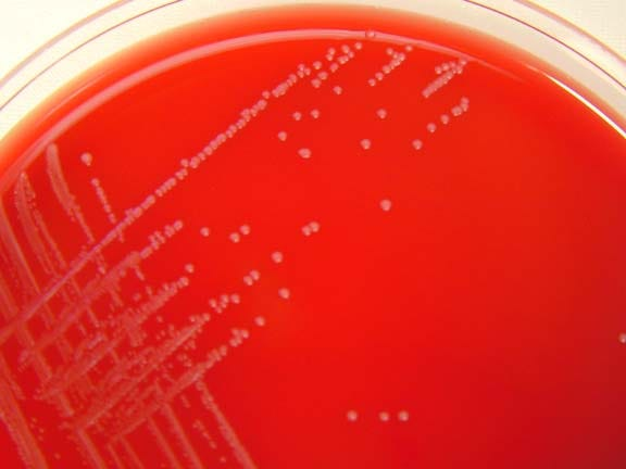 <p>What GPR has <strong>very small translucent gray</strong> colonies with a <strong>narrow zone of beta hemolysis </strong>and <strong>resembles Group B Strep</strong>?</p>