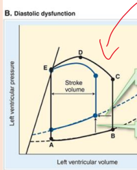 <p>what does an upward shift in the loop indicate?</p>