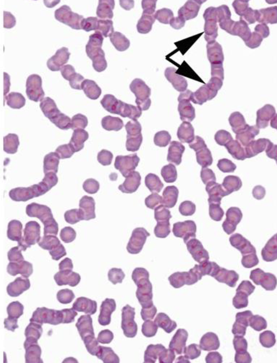 <p>what type of RBC arrangement is this</p>