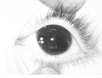 term image