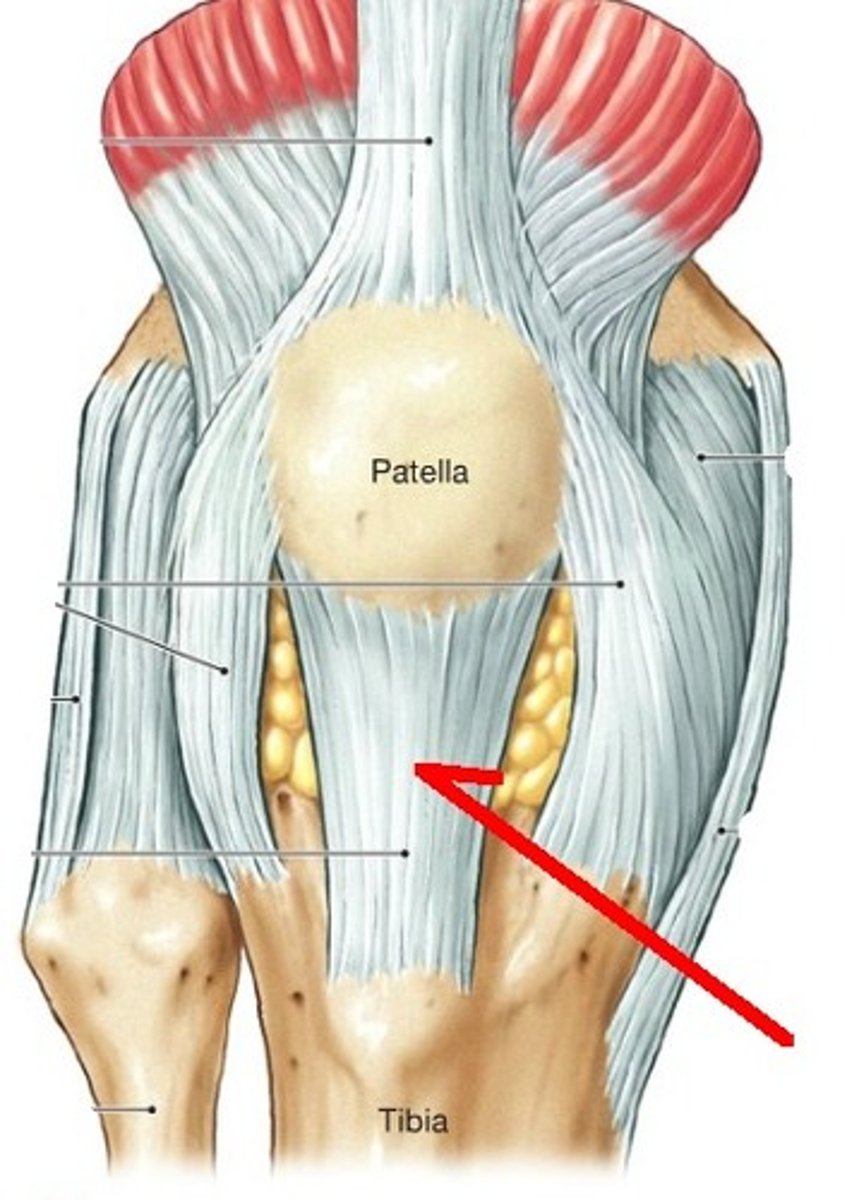 <p>patellar tendonitis</p>