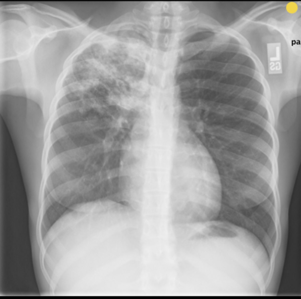 <p>Name the condition</p>