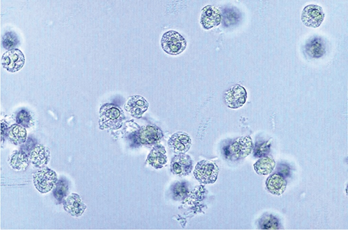 <p>is the predominant WBCs and contains granules and multilobed nuclei</p>
