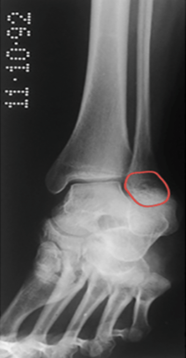 <p>What structure is highlighted?</p>