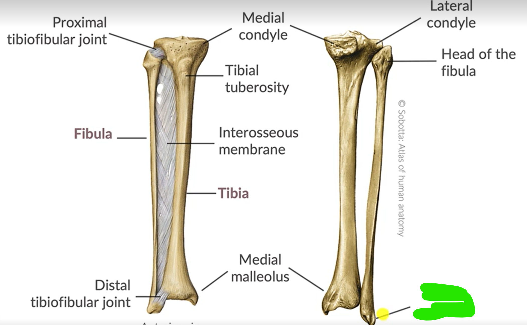 term image