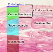 <p>Subendocardial layer</p>