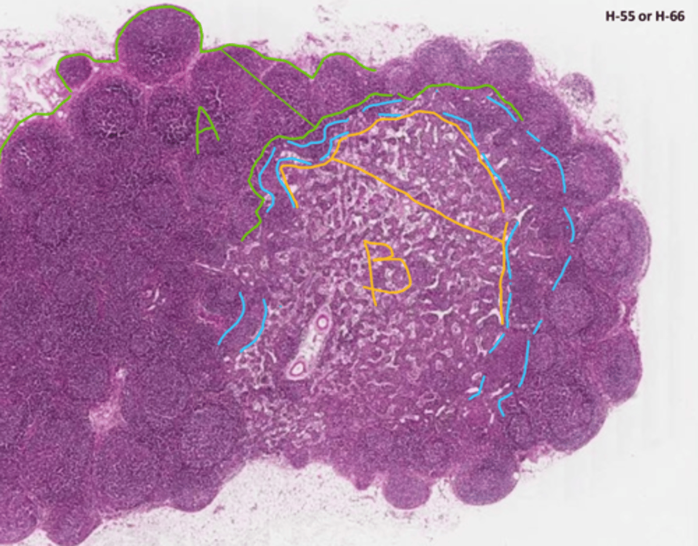 <p>green (lymph node)</p>