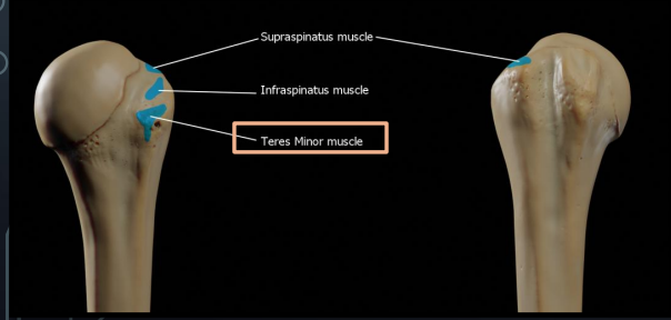 <p>Greater tubercle of the humerus</p>