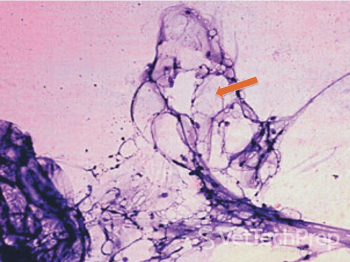 <p>fat-note the clear vacuolated appearance</p>