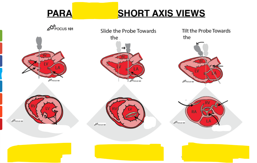 <p>what are these 3 views</p>