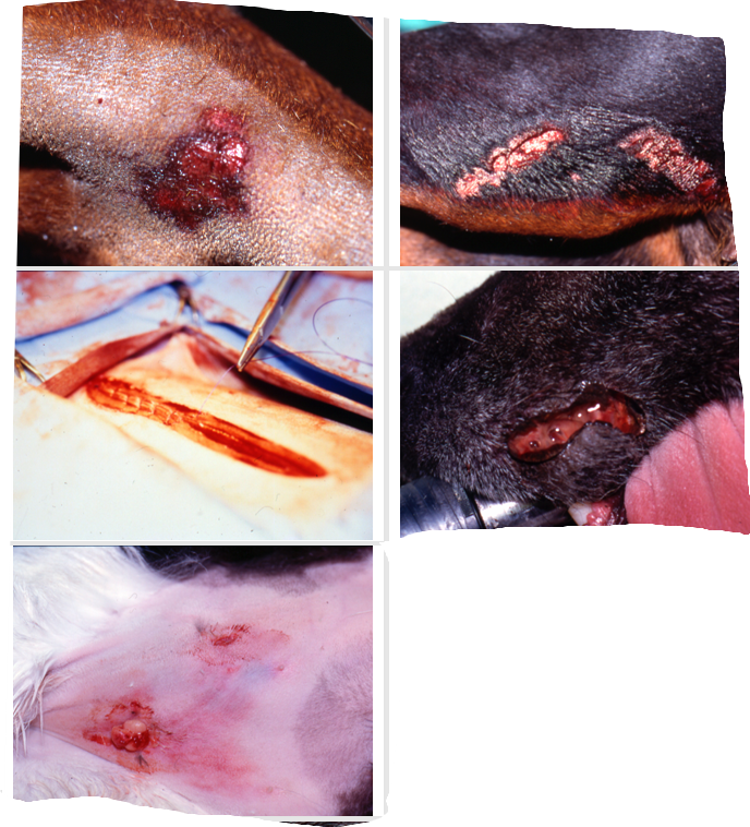 <p>Abrasion: A partial thickness wound with loss of epidermis and part of dermis</p><p>Avulsion: Tearing of tissue from its attachments</p><p>Degloving injury: Low-velocity avulsion of skin due to rotational forces (typically in road accidents).</p><p>Incision: Sharp trauma resulting in a smooth-edged wound with minimal tissue trauma.</p><p>Laceration: Sharp trauma resulting in an irregular wound with tearing of tissue and trauma of underlying tissue.</p><p>Puncture wound: Penetration by a missile or sharp object. Often minimal superficial damage with substantial damage to deeper structures</p>