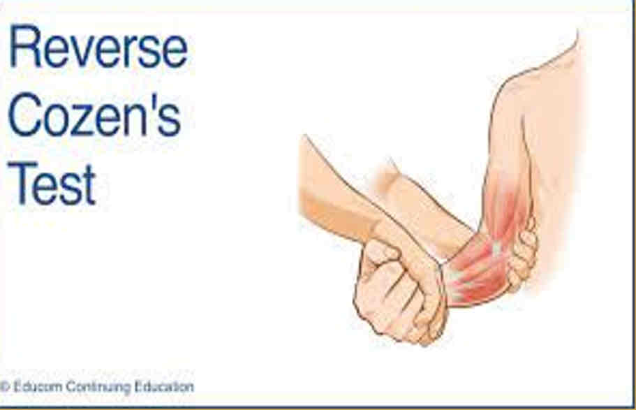 <p><strong><span>Purpose</span></strong><span>: to check medial epicondylitis/ Golfer’s Elbow</span></p><p><strong><span>Steps</span></strong><span>:</span></p><p><span>1.Client is sitting or standing</span></p><p><span>2.Ask the client to put his/her forearm in supination and elbow in 90o of flexion</span></p><p><span>3.Examiner palpates client’s medial epicondyle and asks the client to flex the wrist against resistance</span></p><p><strong><span>Result</span></strong><span>: pain over medial epicondyle</span></p>