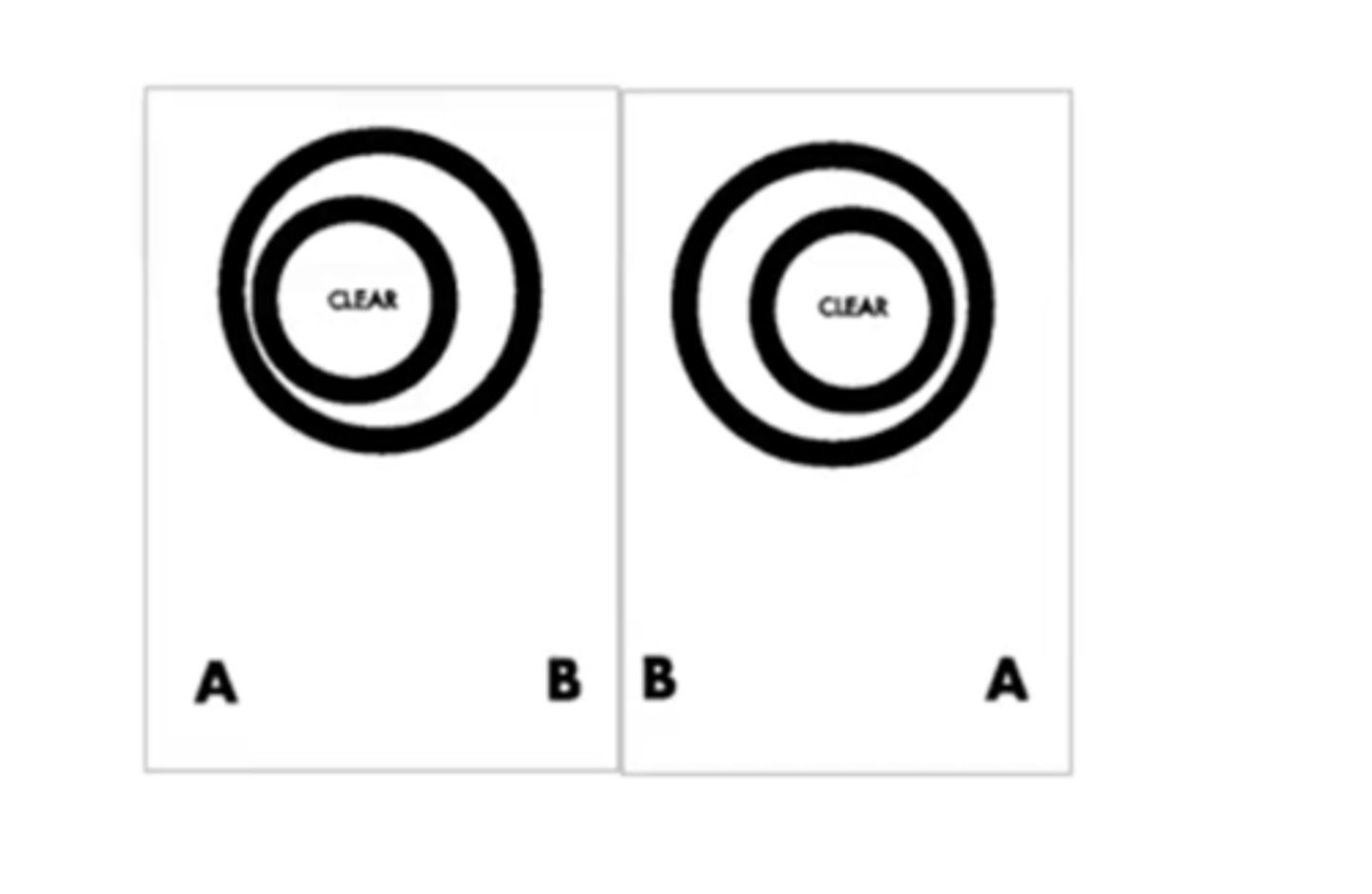 <p>floating towards them = crossed retinal disparity and the only way for pt to see the inner circle leaning towards the left with their right eye would be if the right eye was looking at the left target= thus pt is converging</p><p>uncrossed is inner circle is floating away from pt = divergence</p>