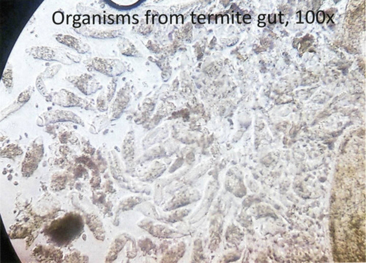 <p>You are examining the hindgut of a termite using 100x magnification and no UV light and observe the relatively large organisms shown in the image above. What are they?</p>