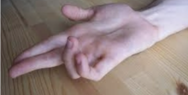 term image