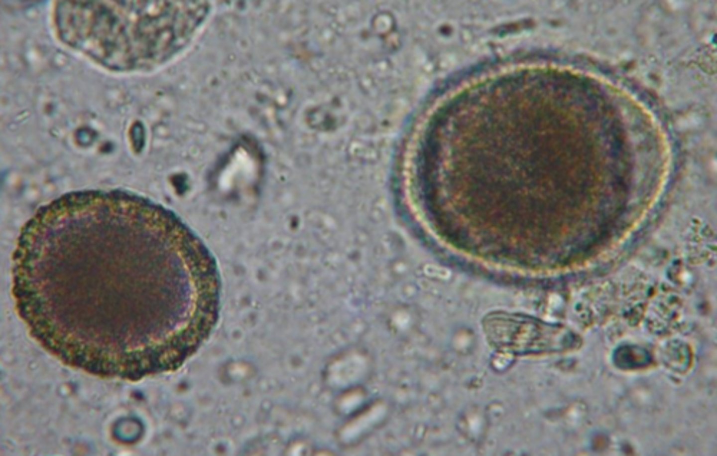 <p>What type of worm in scientific name is presented?</p>