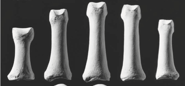 <p>Small finger bones closest to the metacarpals</p>