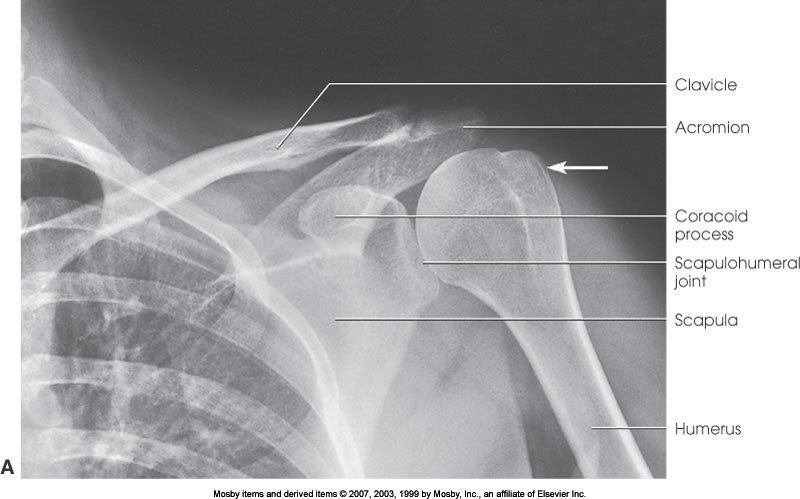 <p>What position is demonstrated?</p>