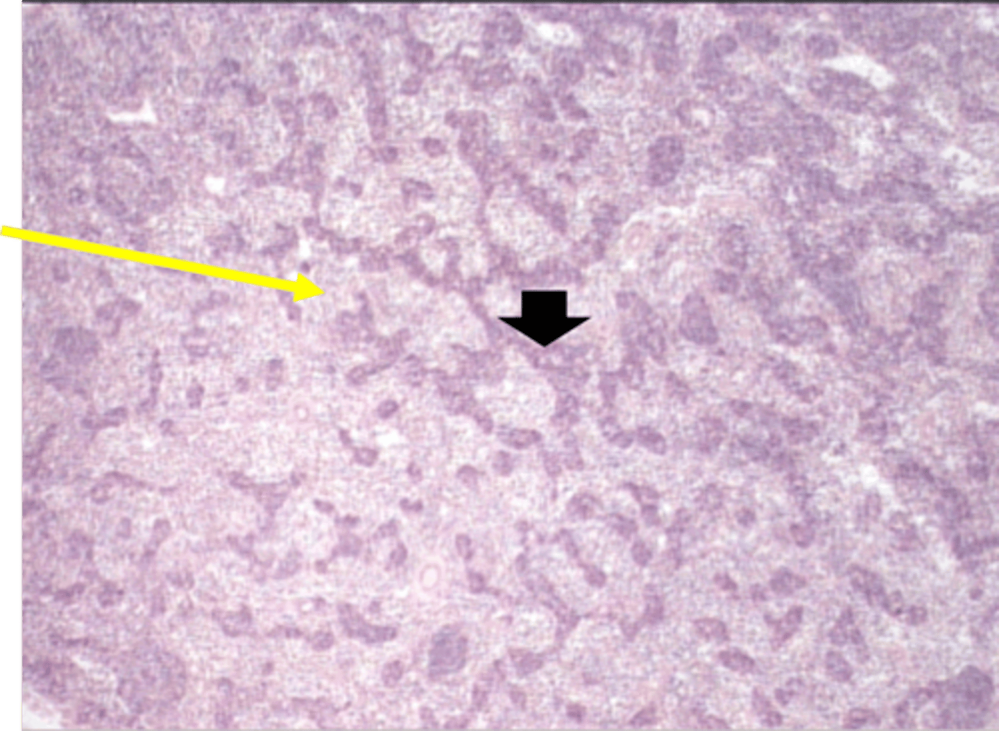 <p>yellow arrow</p><p>medullary sinuses</p>
