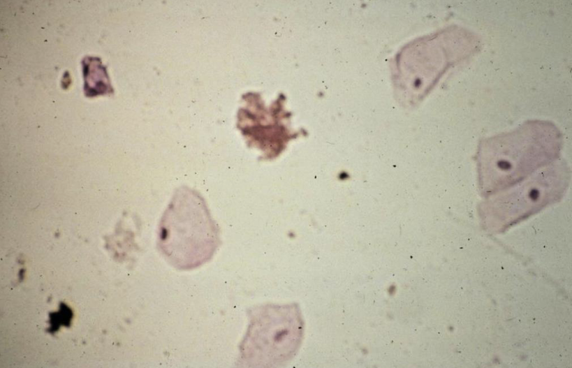 <p><span style="color: #000000">What are these?</span></p><p><span style="color: #000000">Are they </span><span style="color: #000000">common</span><span style="color: #000000">?</span></p>